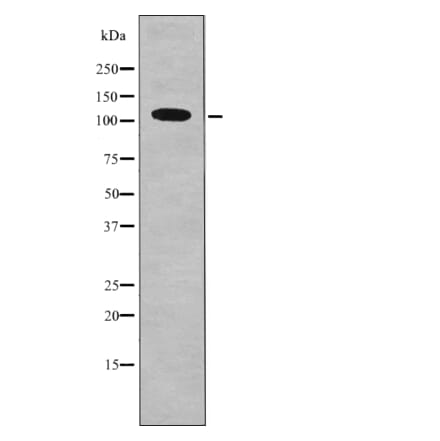 Western blot - DDR1 (Phospho-Tyr796) Antibody from Signalway Antibody (12708) - Antibodies.com