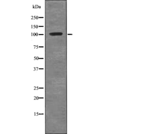 Western blot - ROR1 (Phospho-Tyr786) Antibody from Signalway Antibody (12735) - Antibodies.com