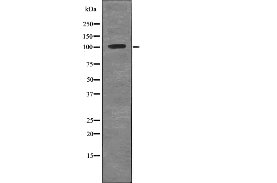 Western blot - ROR1 (Phospho-Tyr786) Antibody from Signalway Antibody (12735) - Antibodies.com
