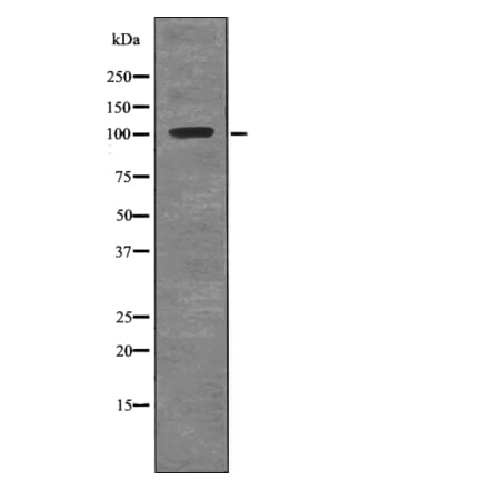 Western blot - ROR1 (Phospho-Tyr786) Antibody from Signalway Antibody (12735) - Antibodies.com