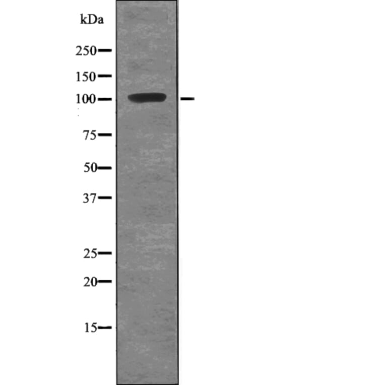 Western blot - ROR1 (Phospho-Tyr786) Antibody from Signalway Antibody (12735) - Antibodies.com