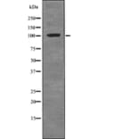 Western blot - ROR1 (Phospho-Tyr786) Antibody from Signalway Antibody (12735) - Antibodies.com