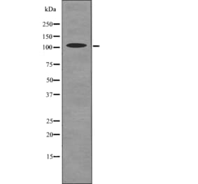 Western blot - ROR2 (Phospho-Ser449) Antibody from Signalway Antibody (12736) - Antibodies.com