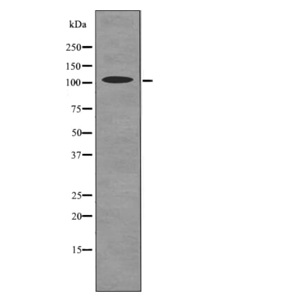 Western blot - ROR2 (Phospho-Ser449) Antibody from Signalway Antibody (12736) - Antibodies.com