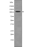 Western blot - ROR2 (Phospho-Ser449) Antibody from Signalway Antibody (12736) - Antibodies.com
