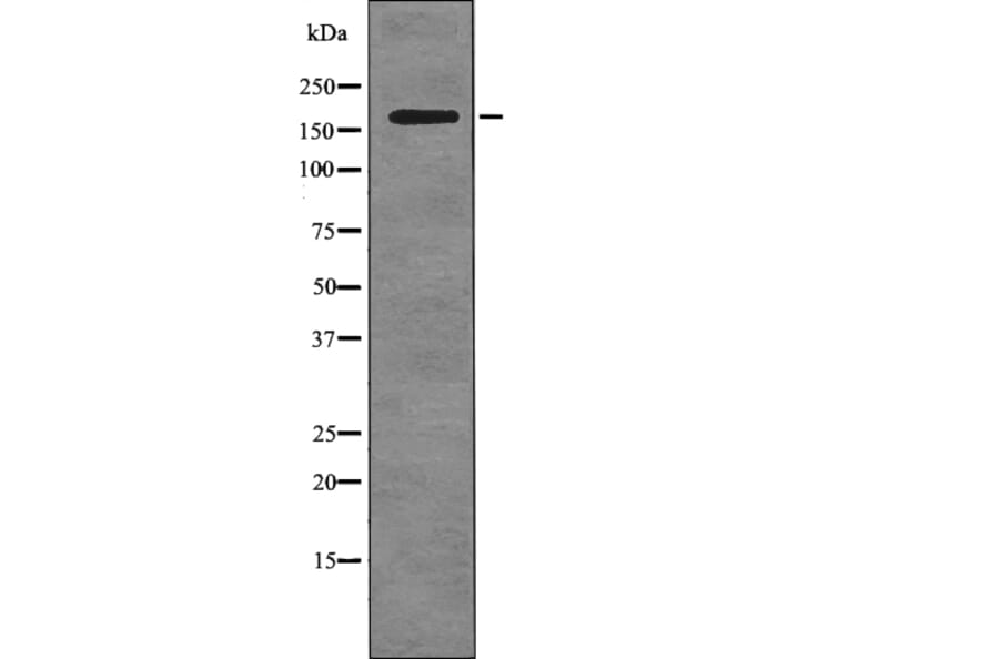 Western blot - ALK (Phospho-Tyr1078) Antibody from Signalway Antibody (12740) - Antibodies.com