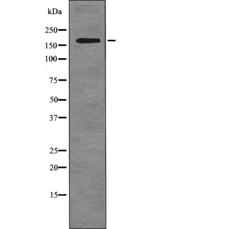 Western blot - ALK (Phospho-Tyr1078) Antibody from Signalway Antibody (12740) - Antibodies.com