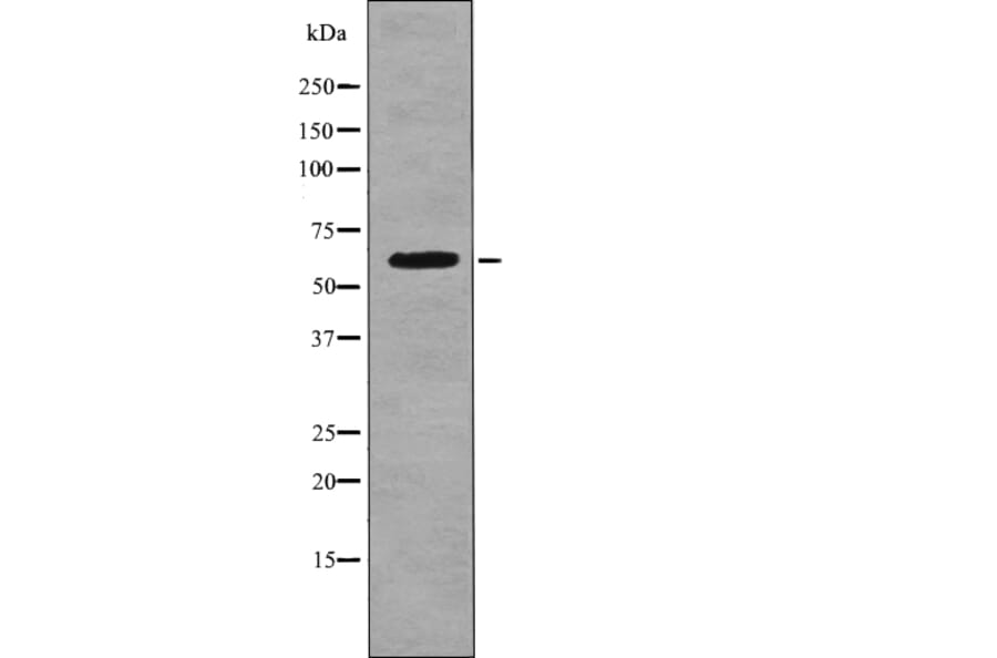 Western blot - CD19 (Phospho-Tyr500) Antibody from Signalway Antibody (12747) - Antibodies.com