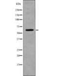 Western blot - CD19 (Phospho-Tyr500) Antibody from Signalway Antibody (12747) - Antibodies.com
