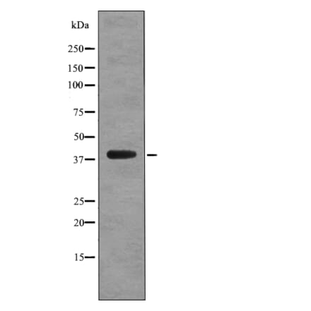 Western blot - CD88 (Phospho-Ser327) Antibody from Signalway Antibody (12748) - Antibodies.com