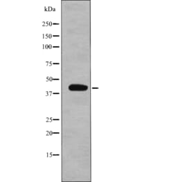 Western blot - eIF2B (Phospho-Ser67) Antibody from Signalway Antibody (12750) - Antibodies.com