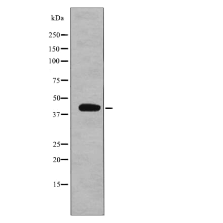 Western blot - eIF2B (Phospho-Ser67) Antibody from Signalway Antibody (12750) - Antibodies.com