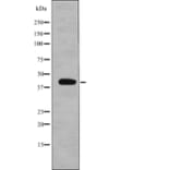 Western blot - eIF2B (Phospho-Ser67) Antibody from Signalway Antibody (12750) - Antibodies.com