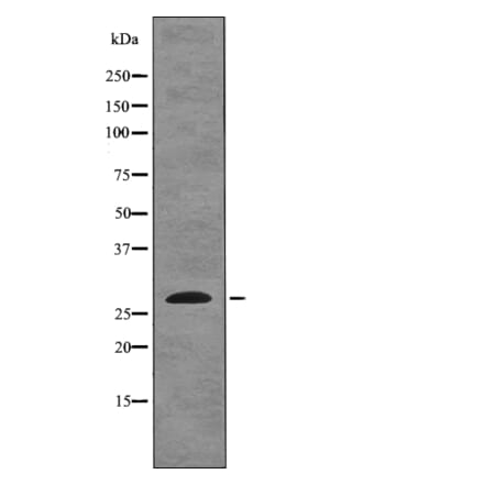 Western blot - EIF6 (Phospho-Ser235) Antibody from Signalway Antibody (12752) - Antibodies.com