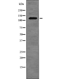 Western blot - FLT3 (Phospho-Tyr955) Antibody from Signalway Antibody (12755) - Antibodies.com