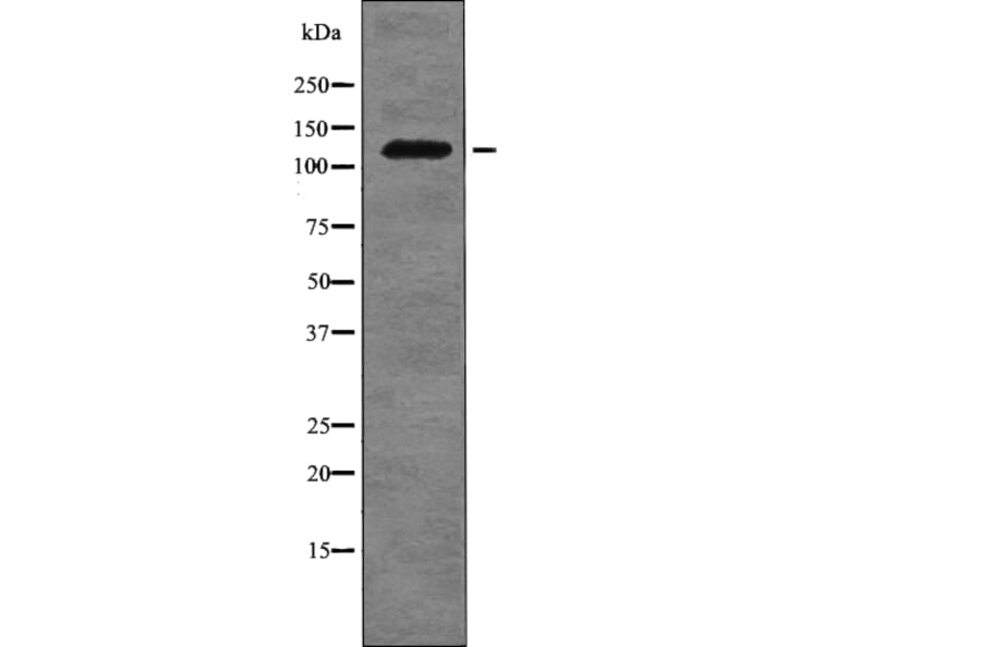 Western blot - FLT3 (Phospho-Tyr955) Antibody from Signalway Antibody (12755) - Antibodies.com