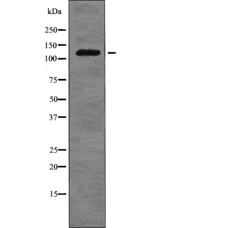 Western blot - FLT3 (Phospho-Tyr955) Antibody from Signalway Antibody (12755) - Antibodies.com
