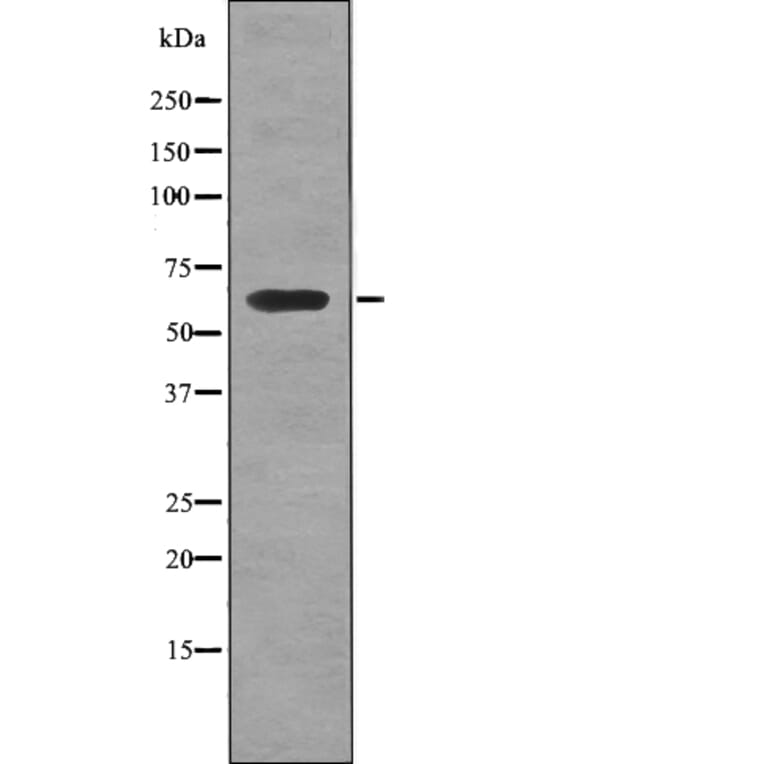 Western blot - PTRF (Phospho-Tyr156) Antibody from Signalway Antibody (12776) - Antibodies.com