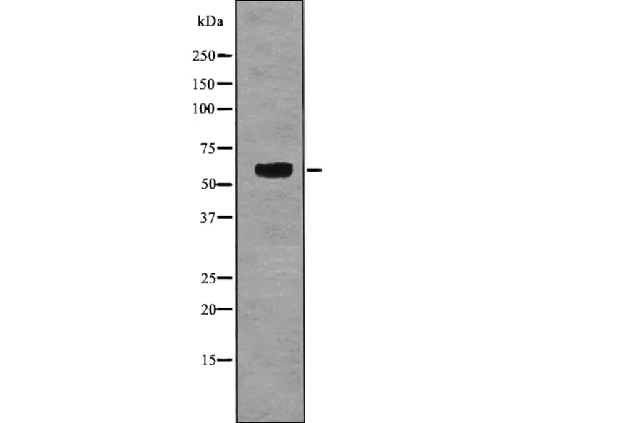 Western blot - TRF2 (Phospho-Ser323) Antibody from Signalway Antibody (12788) - Antibodies.com