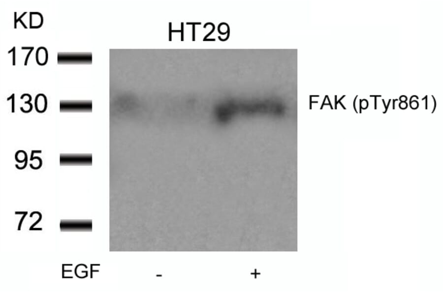 Western blot - FAK (Phospho-Tyr861) Antibody from Signalway Antibody (11059) - Antibodies.com