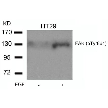 Western blot - FAK (Phospho-Tyr861) Antibody from Signalway Antibody (11059) - Antibodies.com