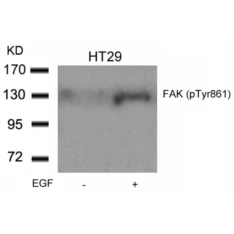 Western blot - FAK (Phospho-Tyr861) Antibody from Signalway Antibody (11059) - Antibodies.com