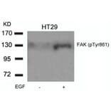 Western blot - FAK (Phospho-Tyr861) Antibody from Signalway Antibody (11059) - Antibodies.com