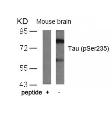 Western blot - Tau (Phospho-Ser235) Antibody from Signalway Antibody (11106) - Antibodies.com
