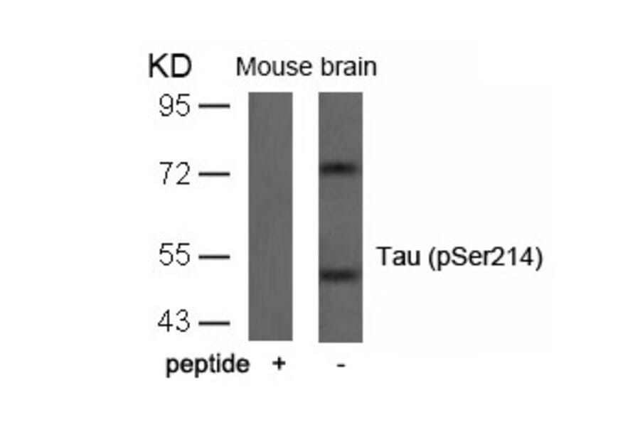 Western blot - Tau (Phospho-Ser214) Antibody from Signalway Antibody (11109) - Antibodies.com