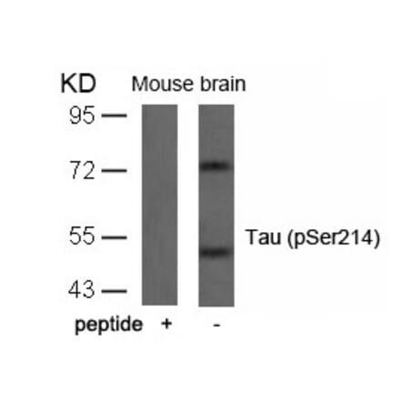 Western blot - Tau (Phospho-Ser214) Antibody from Signalway Antibody (11109) - Antibodies.com
