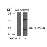 Western blot - Tau (Phospho-Ser214) Antibody from Signalway Antibody (11109) - Antibodies.com