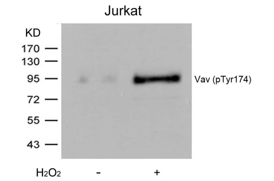 Western blot - Vav (Phospho-Tyr174) Antibody from Signalway Antibody (11142) - Antibodies.com