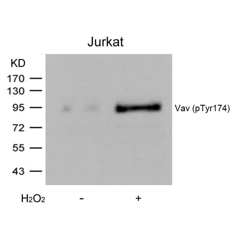 Western blot - Vav (Phospho-Tyr174) Antibody from Signalway Antibody (11142) - Antibodies.com