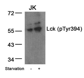 Western blot - Lck (Phospho-Tyr394) Antibody from Signalway Antibody (11144) - Antibodies.com