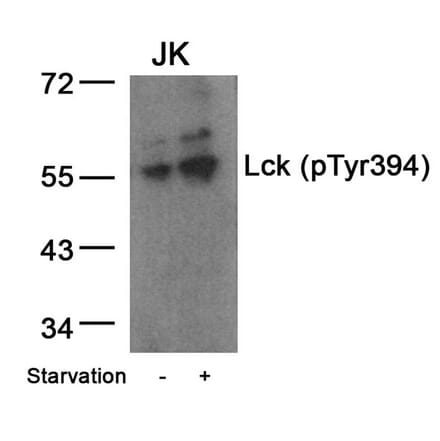 Western blot - Lck (Phospho-Tyr394) Antibody from Signalway Antibody (11144) - Antibodies.com