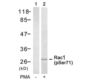 Western blot - Rac1 (Phospho-Ser71) Antibody from Signalway Antibody (11203) - Antibodies.com