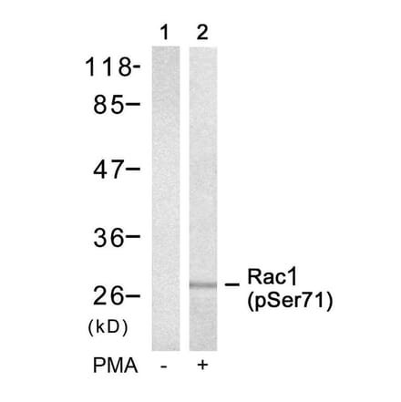 Western blot - Rac1 (Phospho-Ser71) Antibody from Signalway Antibody (11203) - Antibodies.com