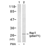 Western blot - Rac1 (Phospho-Ser71) Antibody from Signalway Antibody (11203) - Antibodies.com