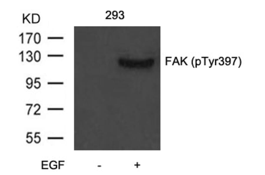 Western blot - FAK (Phospho-Tyr397) Antibody from Signalway Antibody (11215) - Antibodies.com