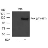 Western blot - FAK (Phospho-Tyr397) Antibody from Signalway Antibody (11215) - Antibodies.com