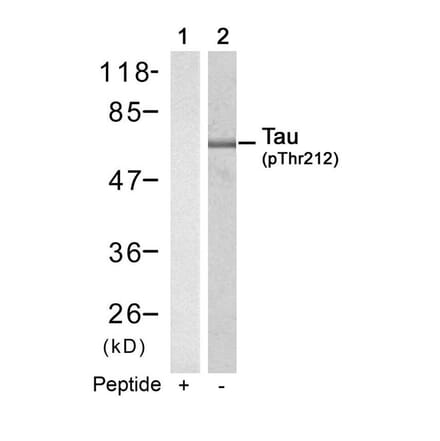 Western blot - Tau (Phospho-Thr212) Antibody from Signalway Antibody (11257) - Antibodies.com