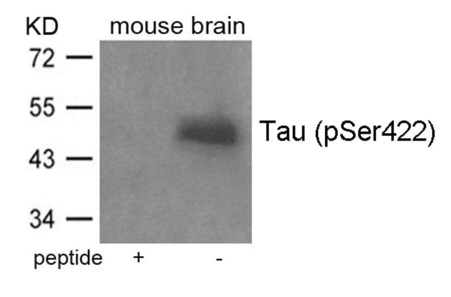 Western blot - Tau (Phospho-Ser422) Antibody from Signalway Antibody (11270) - Antibodies.com