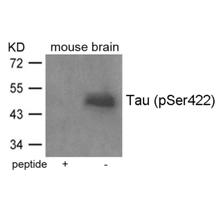 Western blot - Tau (Phospho-Ser422) Antibody from Signalway Antibody (11270) - Antibodies.com
