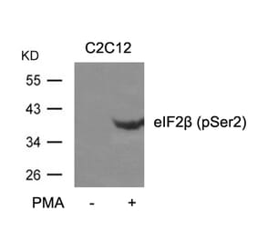 Western blot - eIF2b (phospho-Ser2) Antibody from Signalway Antibody (11512) - Antibodies.com