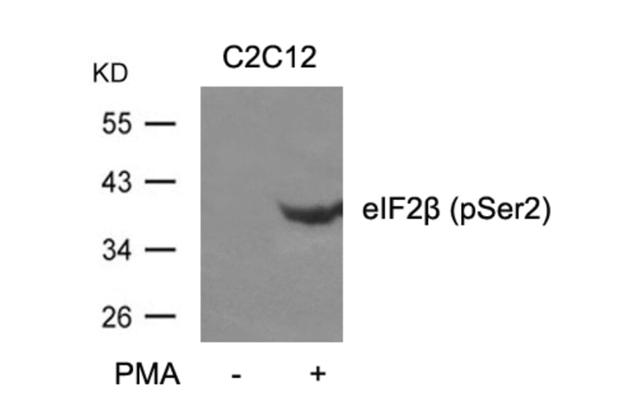 Western blot - eIF2b (phospho-Ser2) Antibody from Signalway Antibody (11512) - Antibodies.com