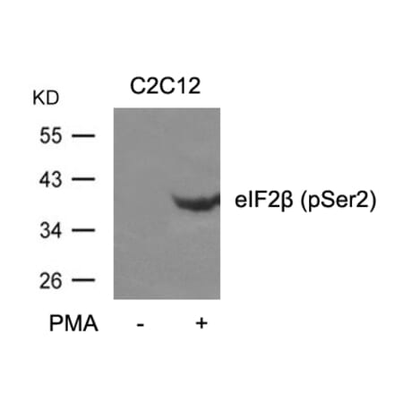 Western blot - eIF2b (phospho-Ser2) Antibody from Signalway Antibody (11512) - Antibodies.com