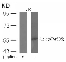 Western blot - Lck (phospho-Tyr505) Antibody from Signalway Antibody (11537) - Antibodies.com