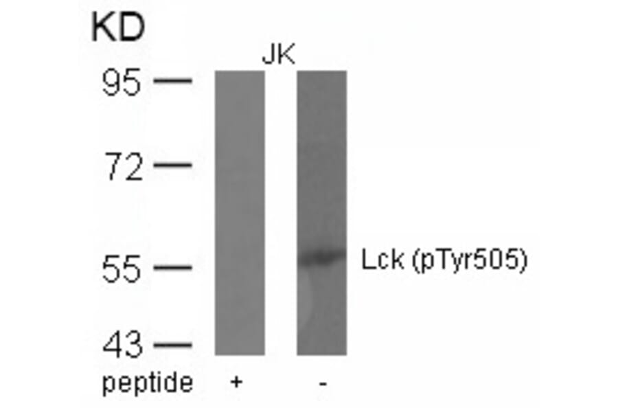 Western blot - Lck (phospho-Tyr505) Antibody from Signalway Antibody (11537) - Antibodies.com