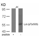 Western blot - Lck (phospho-Tyr505) Antibody from Signalway Antibody (11537) - Antibodies.com