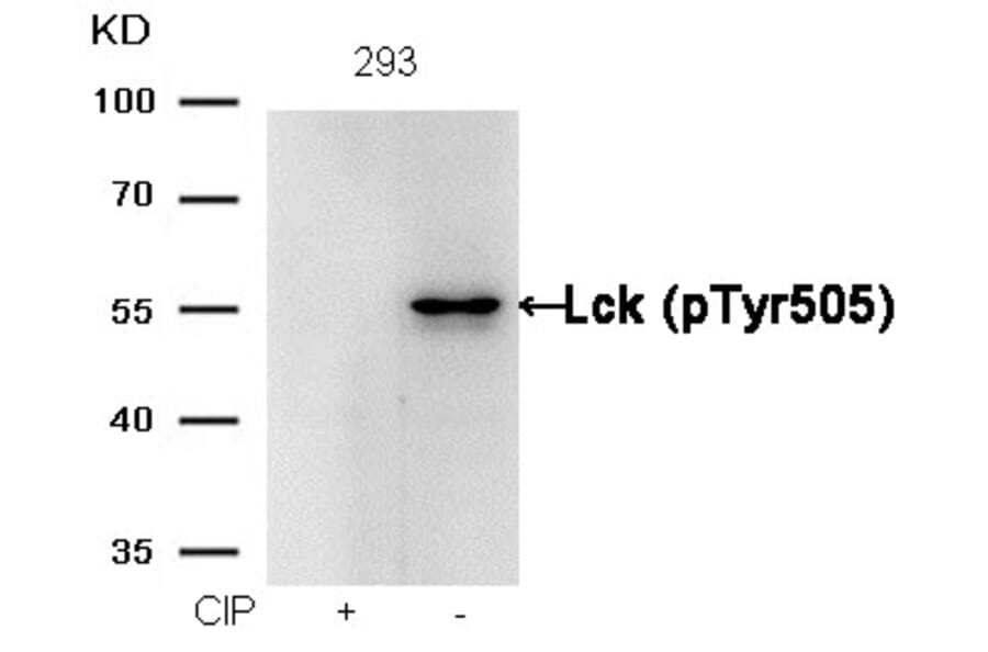 Western blot - Lck (phospho-Tyr505) Antibody from Signalway Antibody (11537) - Antibodies.com